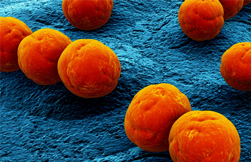 Orange balls of Streptococcus bacteria.