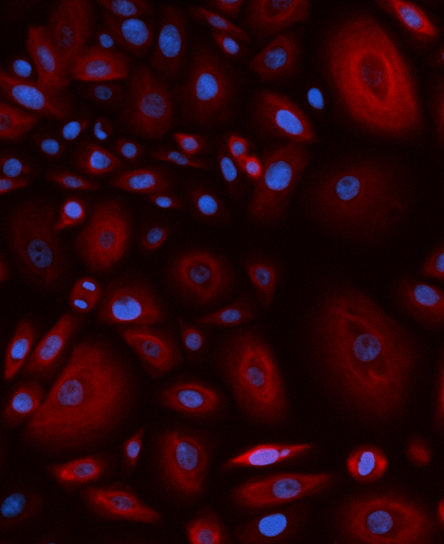 Red and blue gingival keratinocytes.