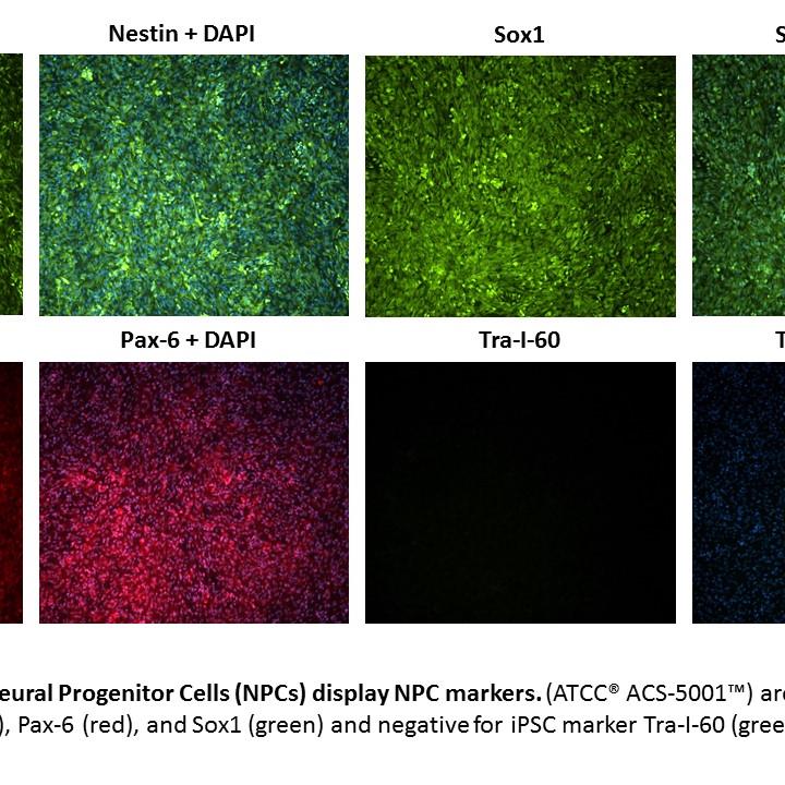 ACS-5001 Parkinsons NPC Marker Expression