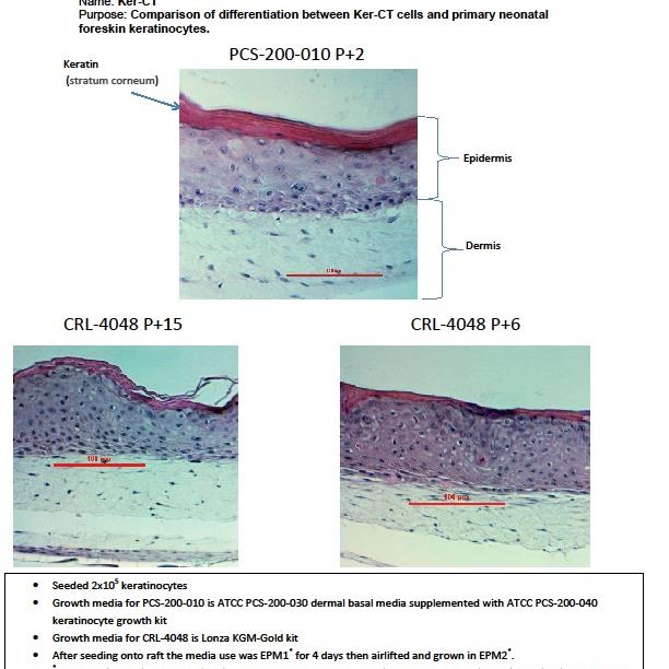 CRL-4048 differentiation 02-2014