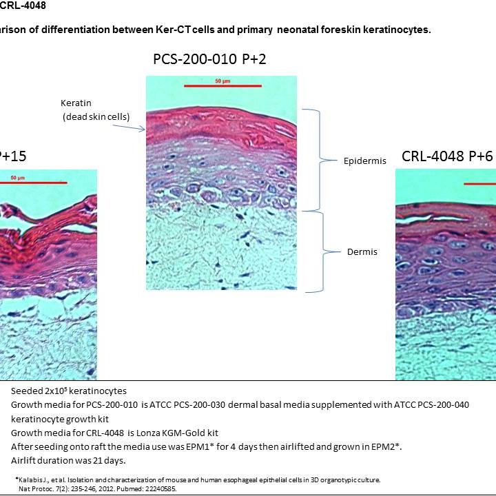CRL-4048 differentiation 21 day 04-2014