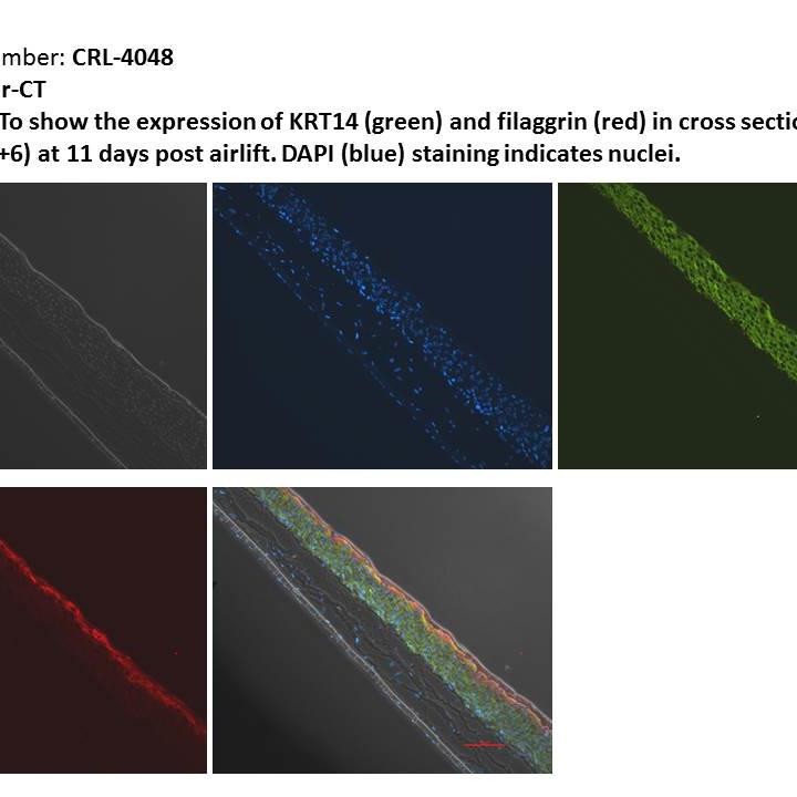 CRL-4048 KerCT 11 Day Differentiation