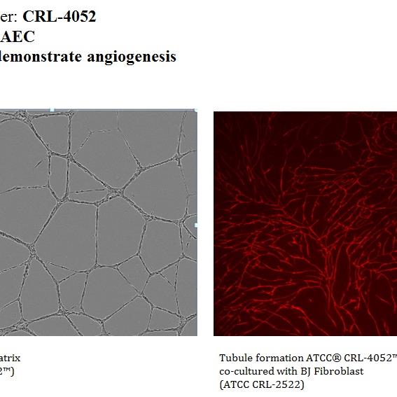 CRL-4052 Angiogensis Co-Culture with BJ