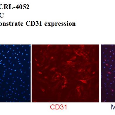 CRL-4052 CD31 Expression