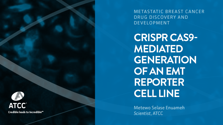 CRISPR Cas9 mediated Generation of an EMT Reporter Cell Line