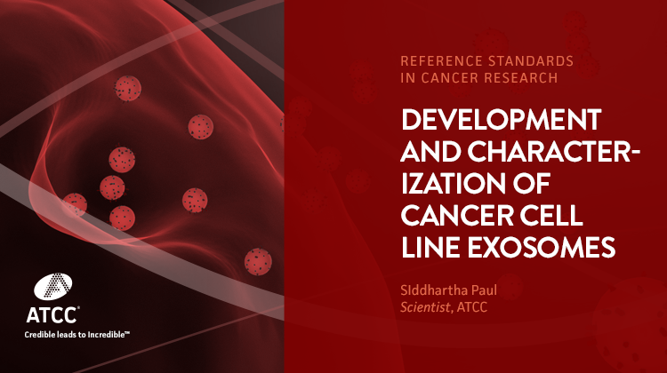 Development and Characterization of Cancer Cell Line Exosomes