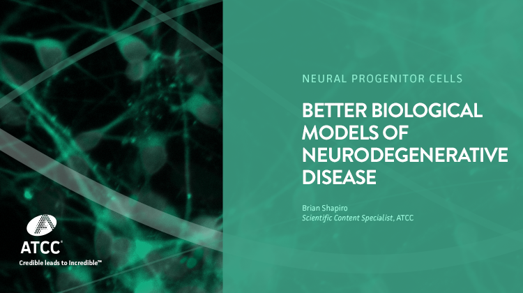 Better Biological Models of Neurodegenerative Disease webinar overlay image
