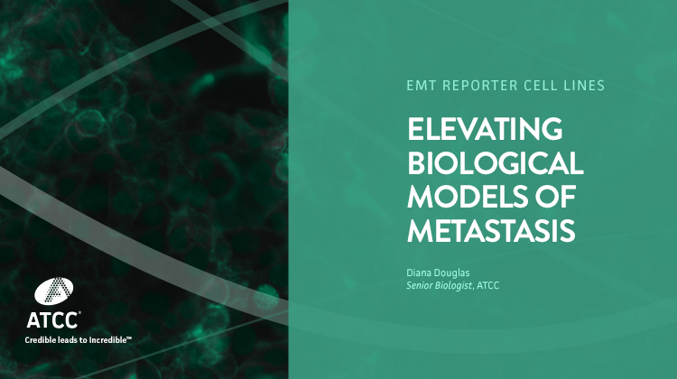 EMT Reporter Cell Lines: Elevating Biological Models of Metastasis webinar overlay image