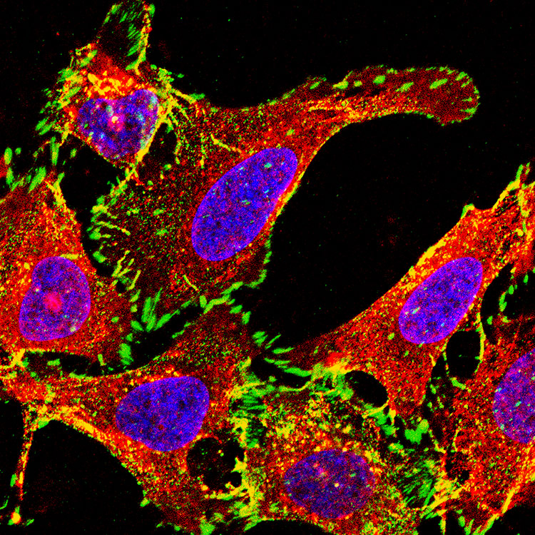 Red, purple, green, and yellow A549 CRISPR cells.