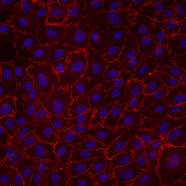 primary-cells-HUVEC-human-umbilical-vein-endothelial-cells-red-purple Purple, red and black human umbilical vein endothelial cells.