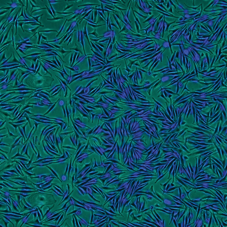 melanocyte primary, cells, primary cells, melanocyte, mature melanin forming cell, pigment, blue, green