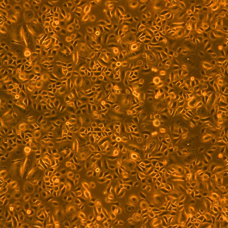 bronchial-tracheal-epithelial-cells2 primary, cells, primary cells, bronchial, tracheal, bronchial-tracheal, epithelial, HBTEC, airway, lung, bronchi, orange