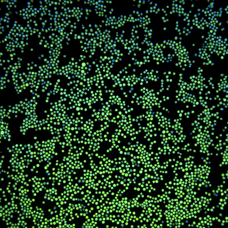 K562-GFP-with-nuclear-stain Green K562-GFP with nuclear stain.