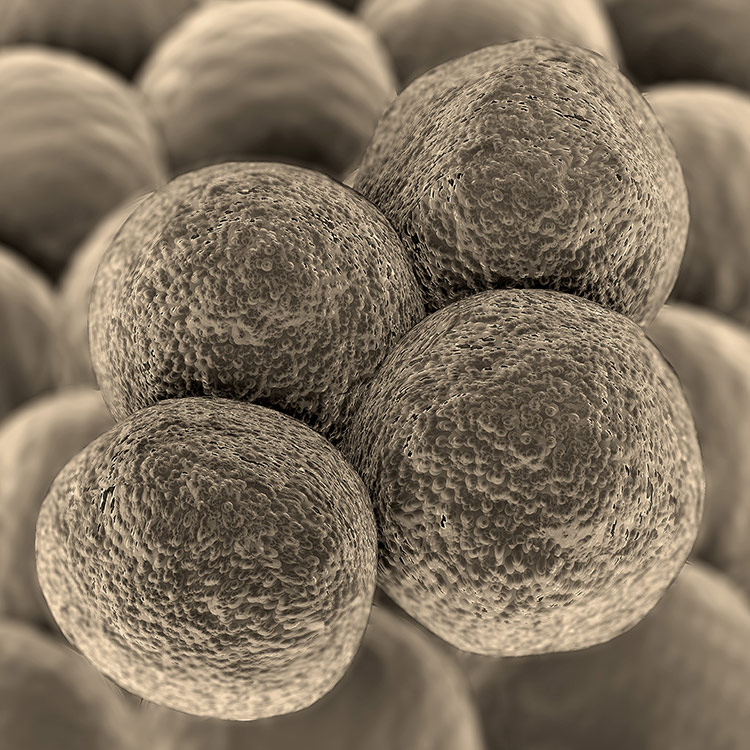 T-lymphocytes-cancer-cell T-lymphocytes cancer cell.