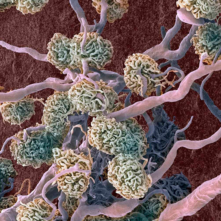 kidney-cells hTERT kidney renal proximal tubular epithelial cells.