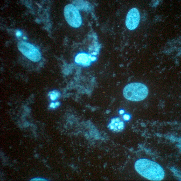 mycoplasma-blue Blue mycoplasma cells.