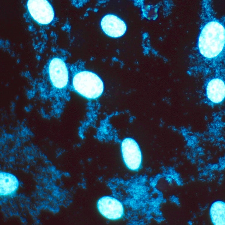 m-hyorhinis-3-bacteria Blue m-hyorhinis mycoplasma cells.