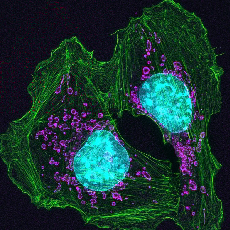 Mouse skin cancer cells Purple and green top mouse skin cancer cells.