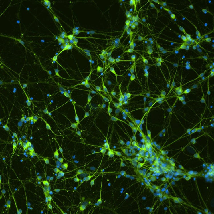 npcs-neural-progenitor-cells-ACS-5003-Dopaminergic Diff Green and blue dopaminergic Diff Tuj1 DAPI cells.