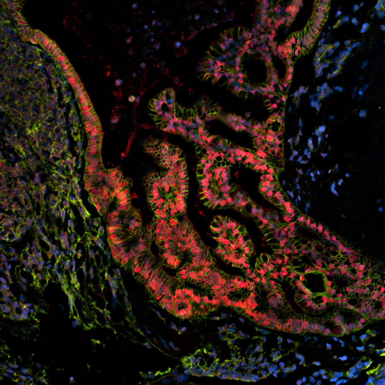 IPS cells-acs-1019 Blue, pink and green IPS organoid cells.