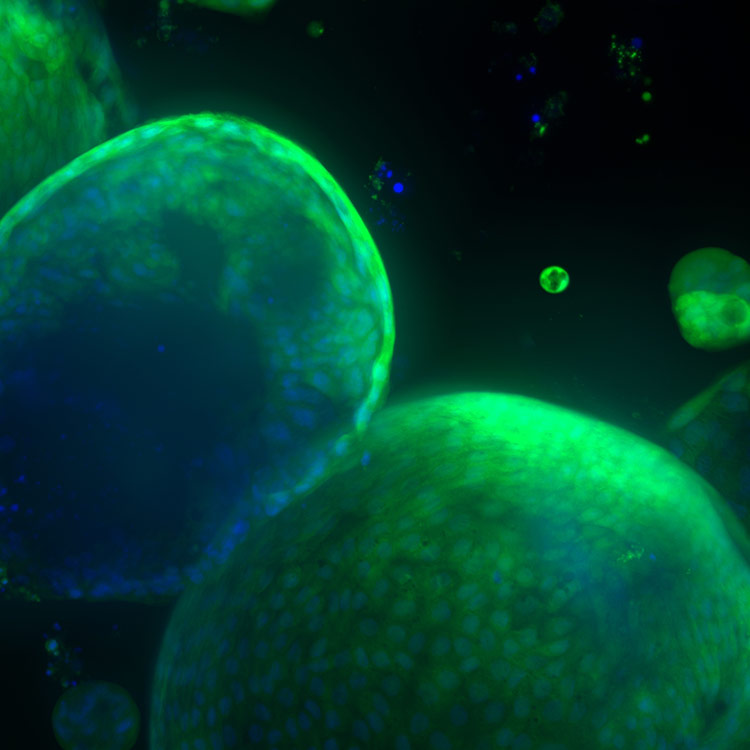 organoid-ICC cells, organoid, ICC, 95636, AM, A01f03, green