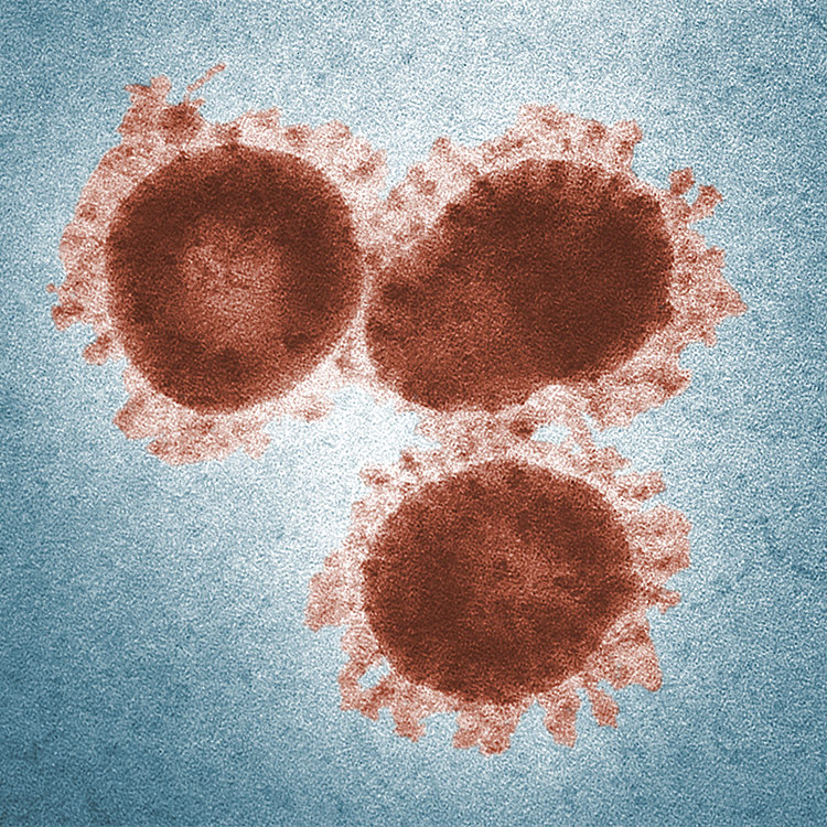 coronavirus Coronavirus cells.