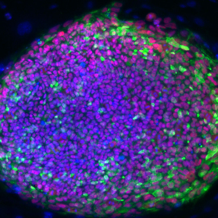 ATCC-24166-ATCC-58593-ascomycoteous-fungi-mycrosporum-gypseum cells, ATCC, 24166, 58593, ascomycoteous fungi, mycrosporum gypseum, photo contest 11, Wenjun-Li