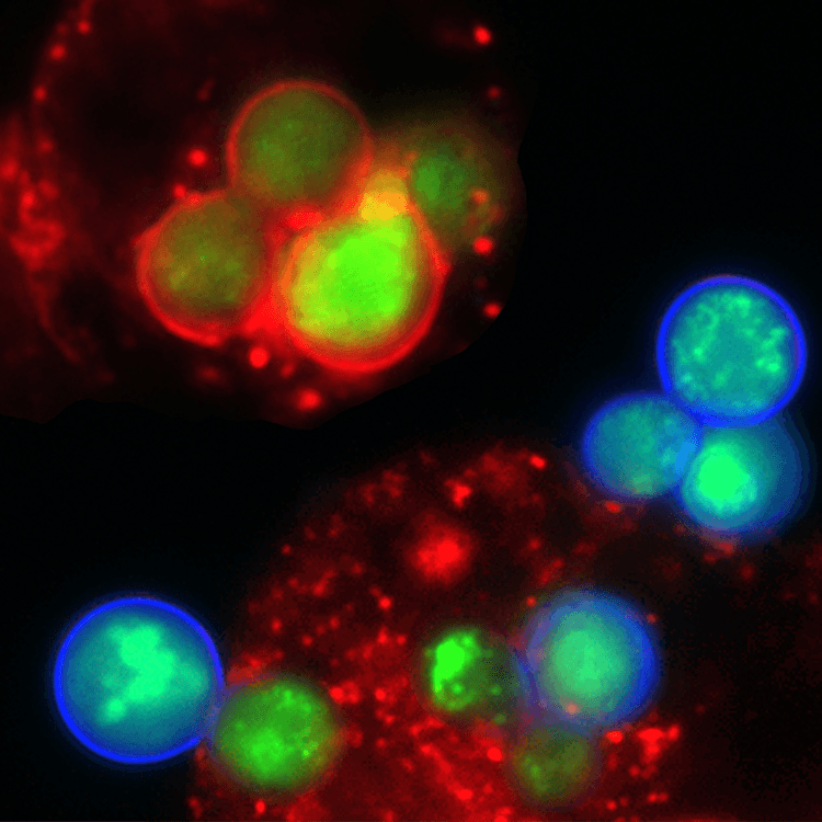 ATCC-26199-yeast-with-macrophage Greena and red yeast with macrophage cells.