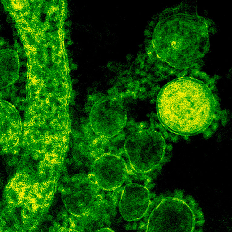 MERS-CoV-18111 Green MERS-CoV cells.