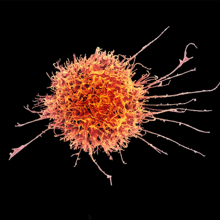 human-natural-killer-cell-orange-red