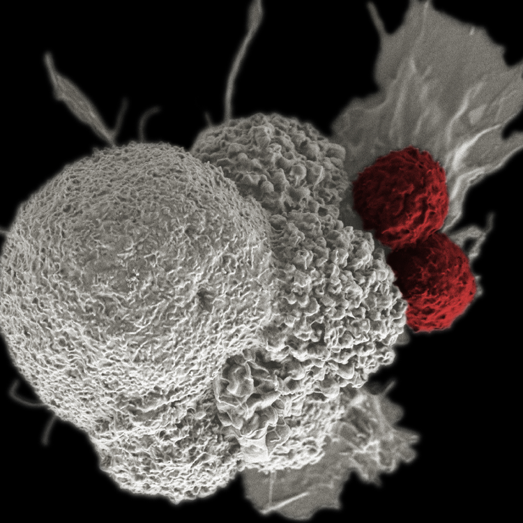 cancer-immunotherapy-white-oral-squamous-red-cytotoxic-T-cells