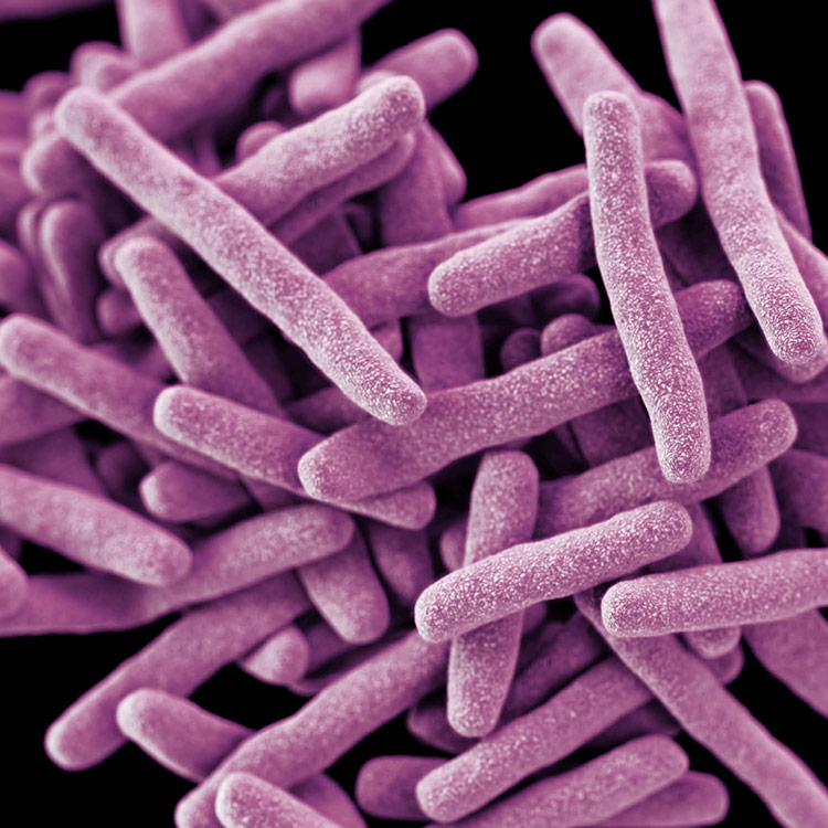mycobacterium-tuberculosis-pink Cluster of thin, pink, rod-shaped Mycobacterium tuberculosis.