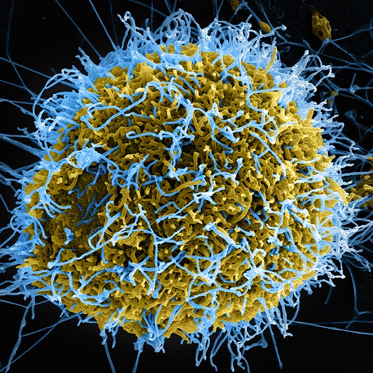 Ebola virus budding from Vero cell Ebola virus budding from Vero cell