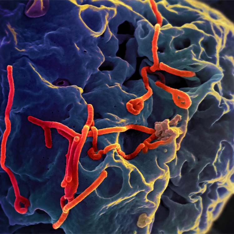 Ebola virus budding from Vero cell red
