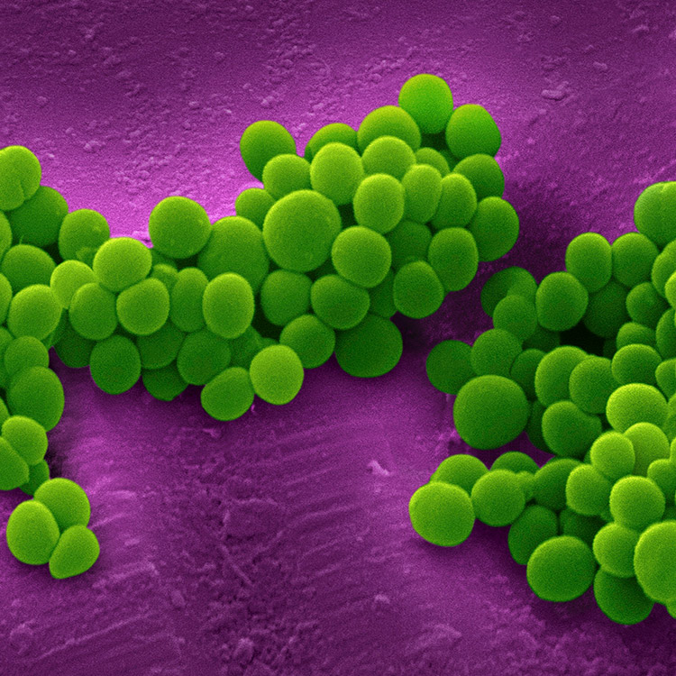 Cluster of green, grape-shaped methicillin-resistant Staphylococcus aureus bacteria.