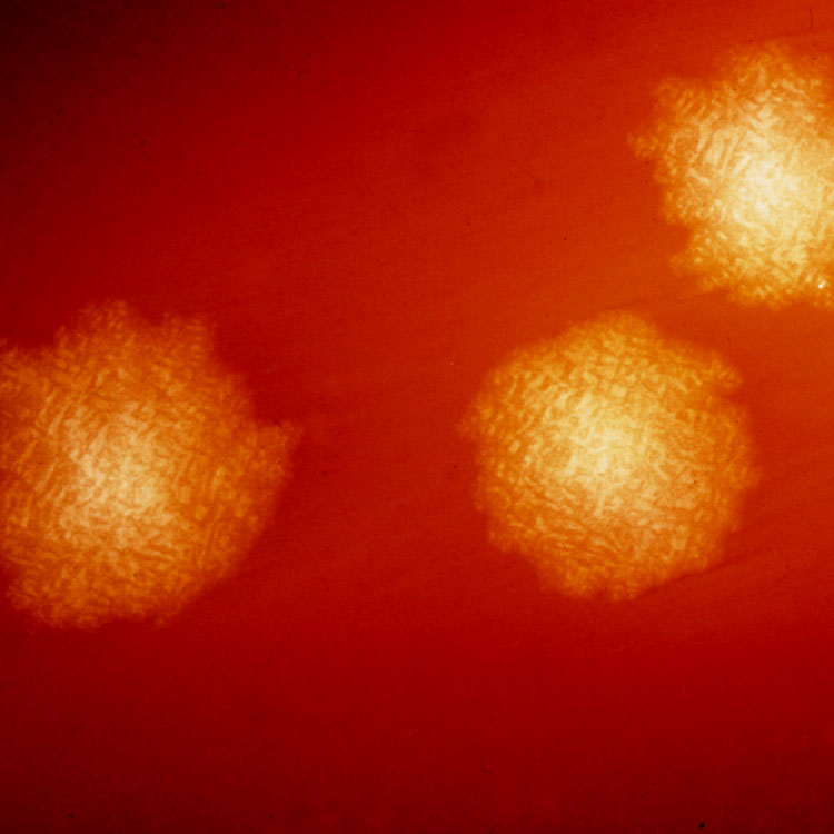 c-diff-blood-agar Orange-yellow, textured spheres of Clostridium difficile bacteria.