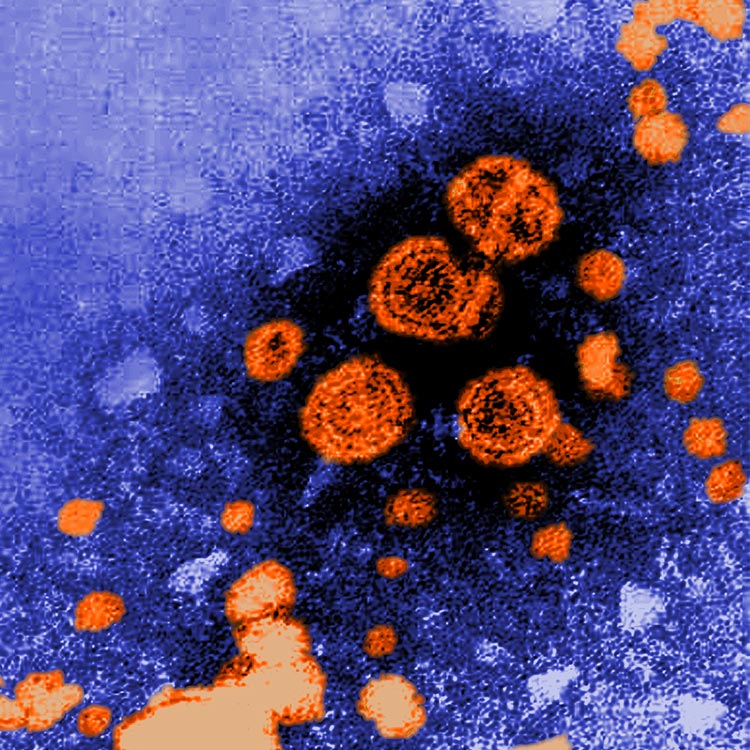 Hepatitis Grainy, blue and orange Hepatitis virus.