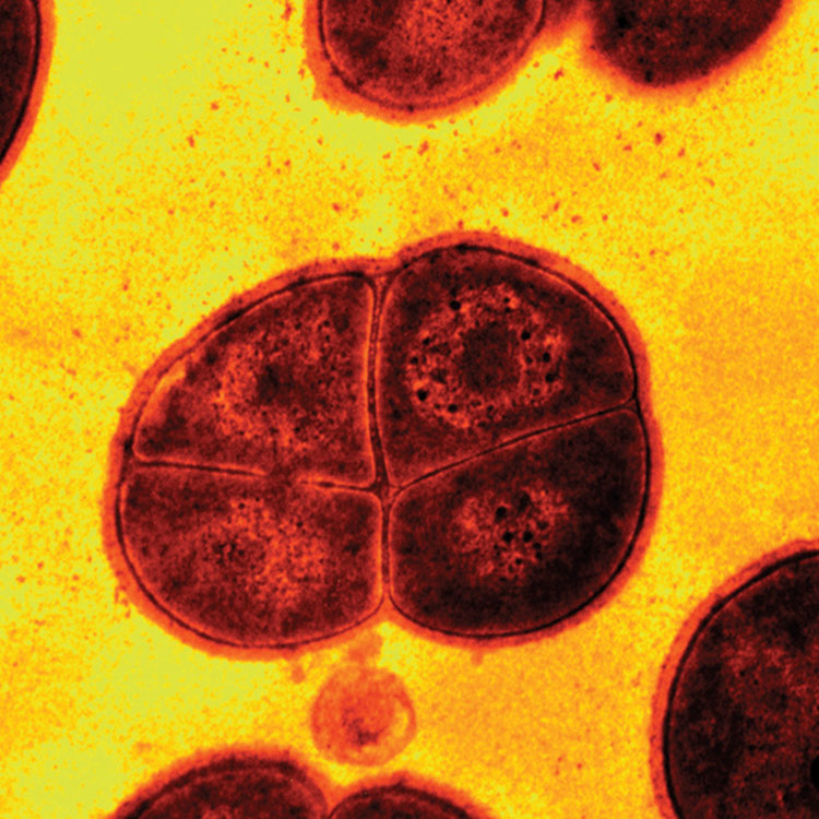 Grainy red and black Deinococcus radiodurans extremophilic bacterium.