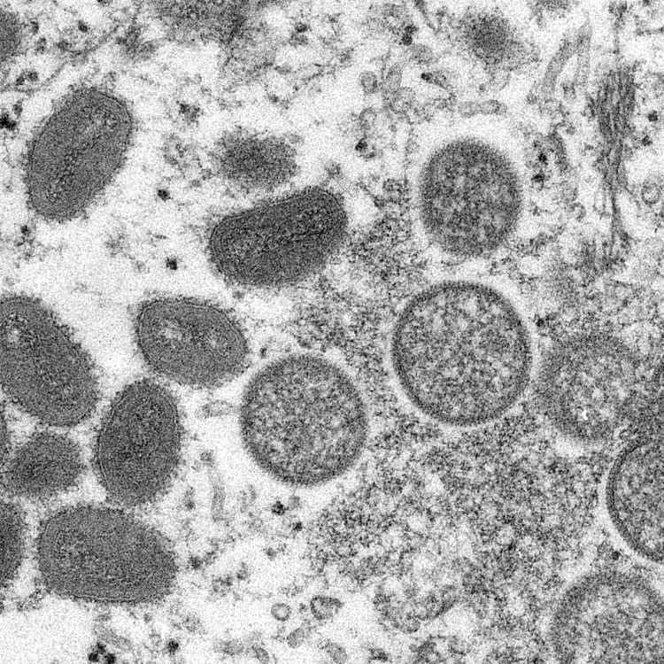 Monkeypox virus Monkeypox virus