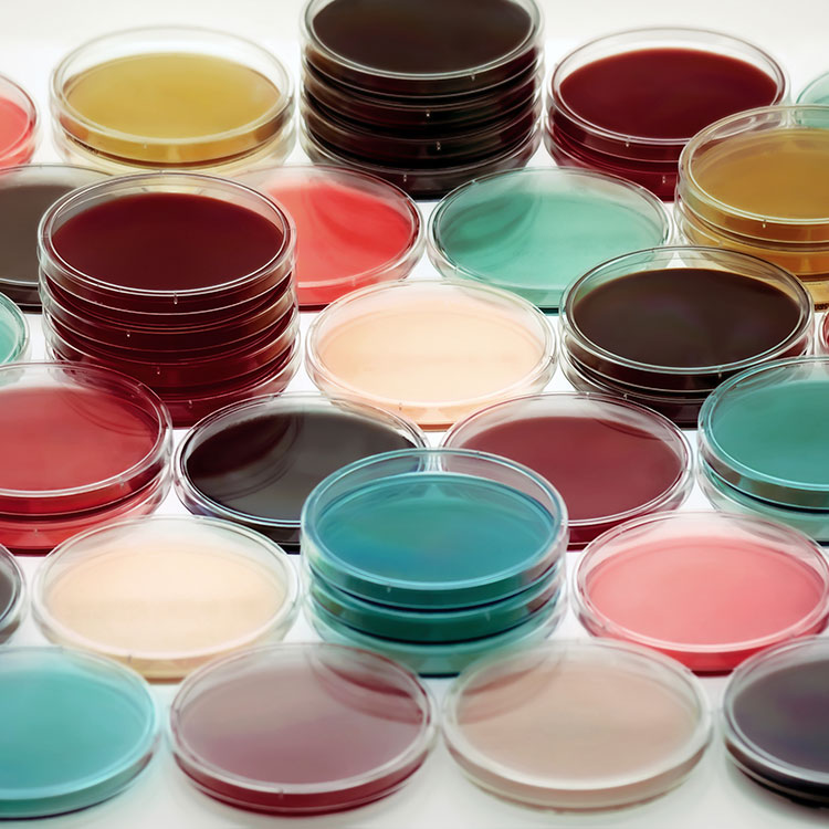 Several petri dishes containing media of various colors.