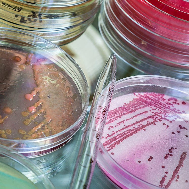 petri-bacillus-bacteria-pipette Empty pipette laying between petri dishes containing bacillus bacteria cultures.