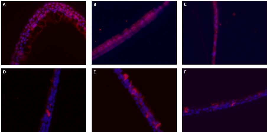 Representative ICH-stained images of (A) untreated control airway models, airway models exposed to (B) 14.0, or (C) 147.9  µM CdCl₂ for 2 weeks.