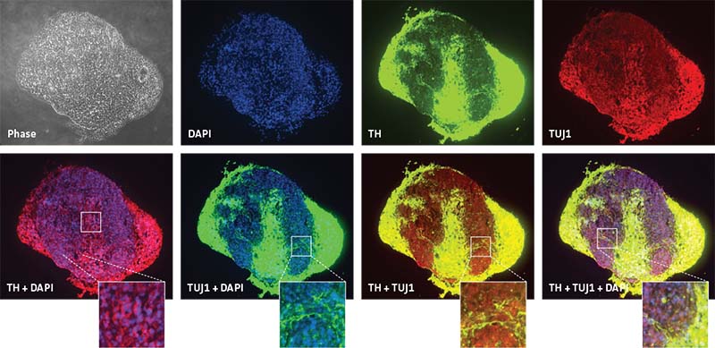  Fig 5 Parkinson’s disease neurospheres