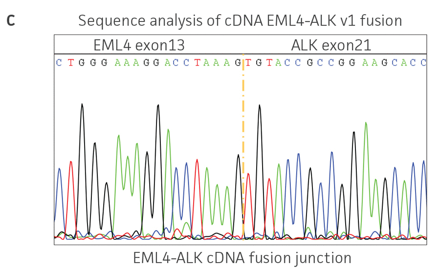 Sequence analysis of cDNA EML4-ALK v1 fusion.