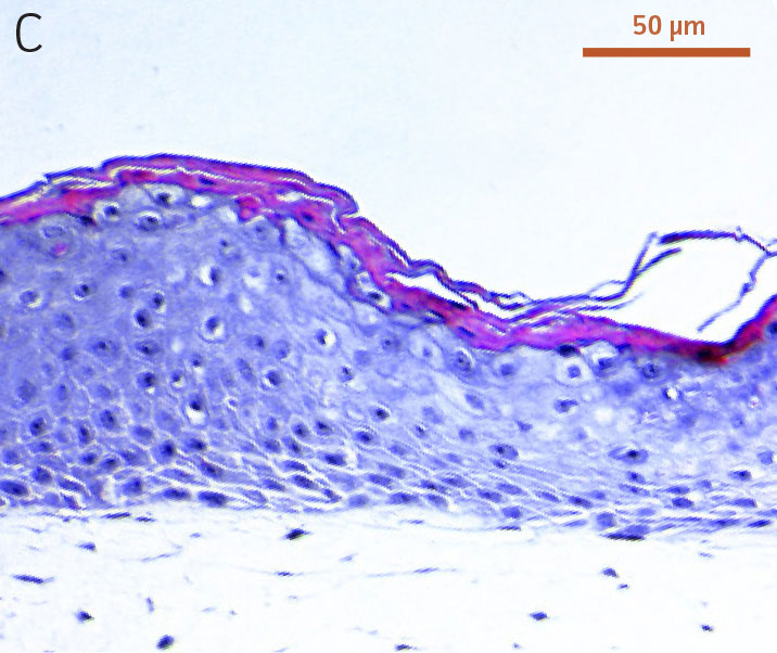 Ker-CT cells at passage 15, on collagen gel embedded with primary foreskin dermal fibroblasts.