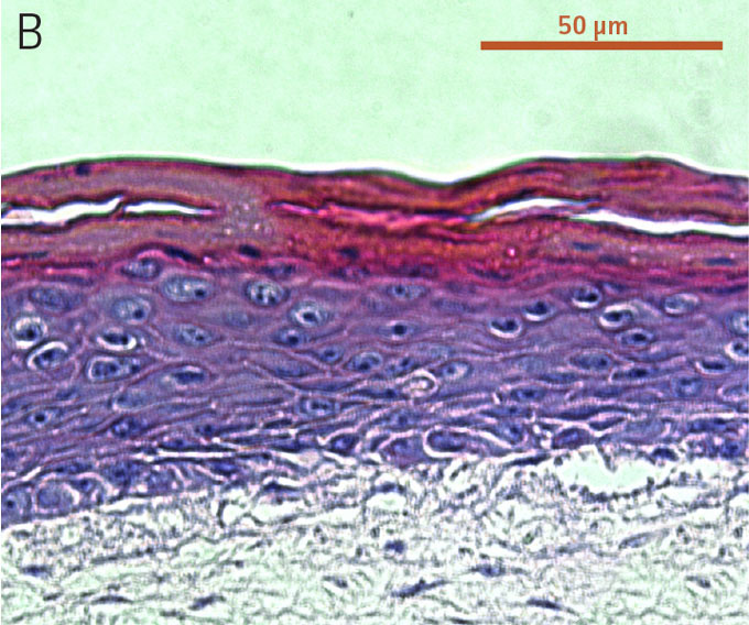 Ker-CT cells at passage 6.