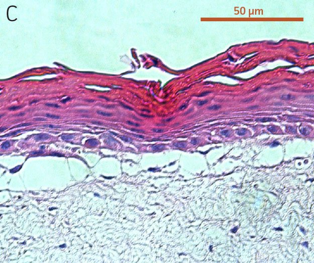 Ker-CT cells at passage 15, after 21 days post ALI culture.
