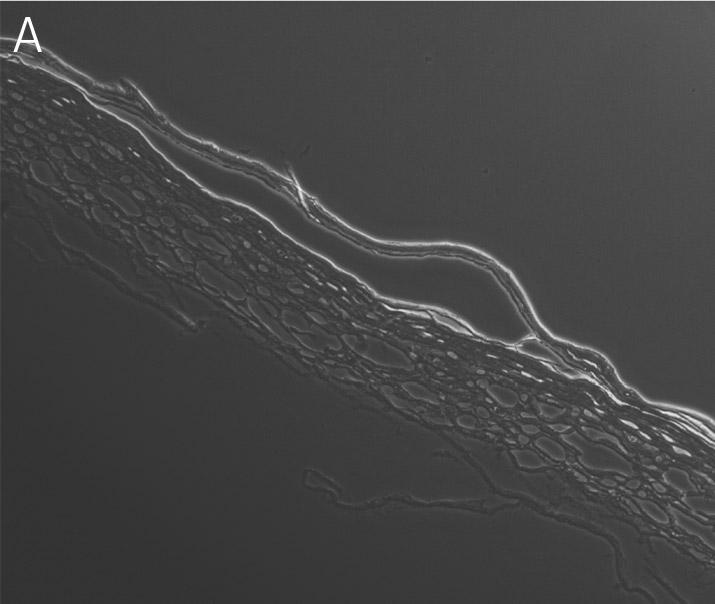 Primary keratinocytes at 10x magnification.