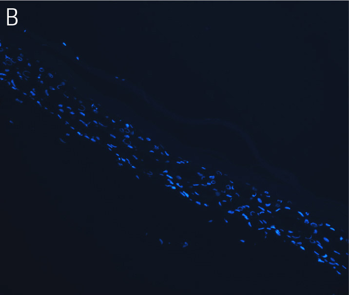 Keratinocytes stained with DAPI.
