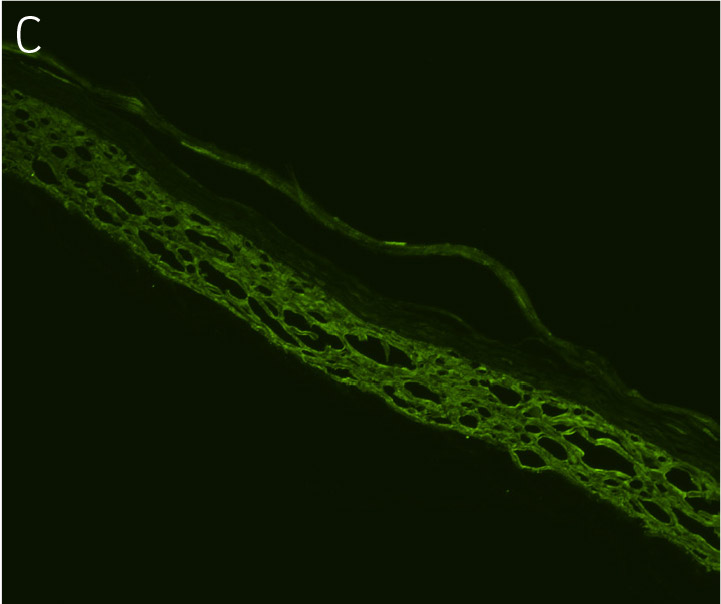 Keratinocytes with antibodies directed against KRT14.